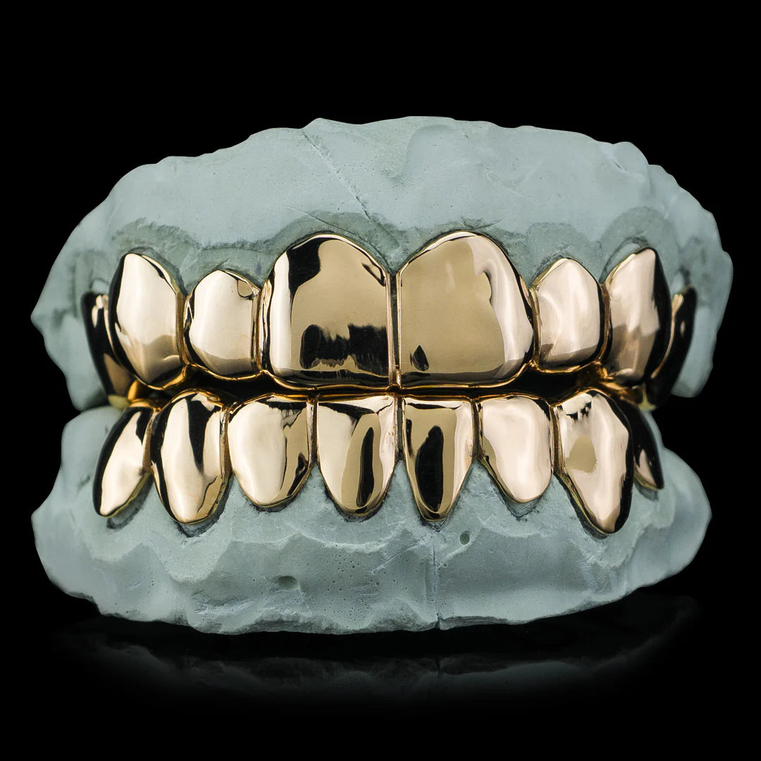 Gold Grillz with Diamond Accents